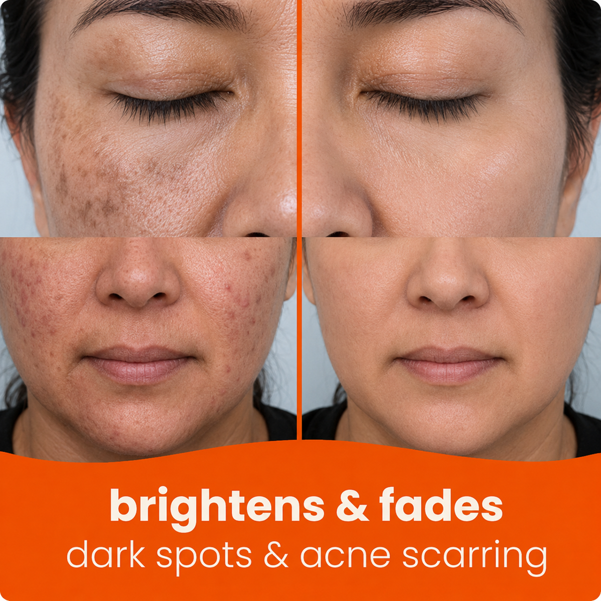 🔥Last Day 68% OFF-Juxek Turmeric Kojic Glow Pads