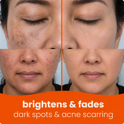 🔥Last Day 68% OFF-Juxek Turmeric Kojic Glow Pads