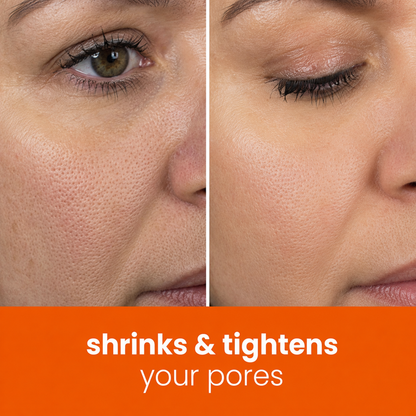 🔥Last Day 68% OFF-Juxek Turmeric Kojic Glow Pads